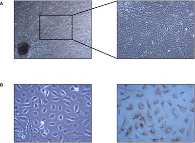 Microbial interventions in yak colibacillosis: Lactobacillus-mediated regulation of intestinal barrier